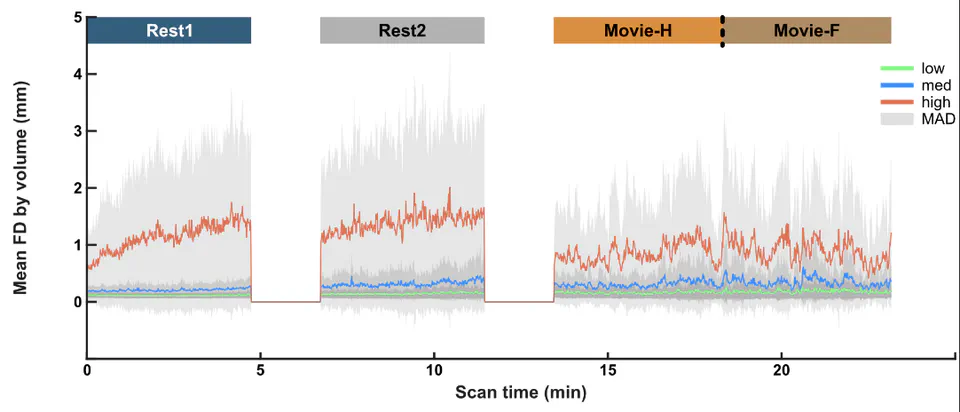 Getting the nod: Pediatric head motion in a transdiagnostic  sample during movie-and resting-state fMRI