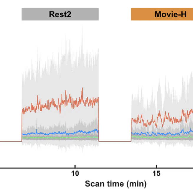 Getting the nod: Pediatric head motion in a transdiagnostic  sample during movie-and resting-state fMRI